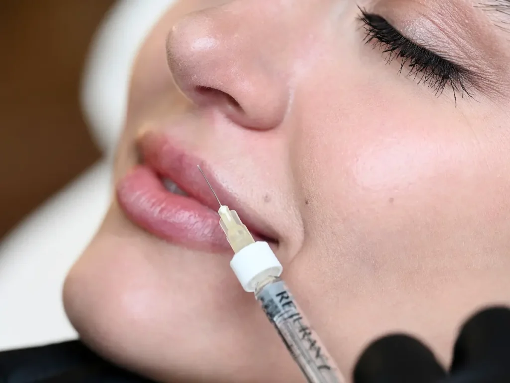 Facial Harmonization Techniques - MedSpa Grupo Estético CB Miami