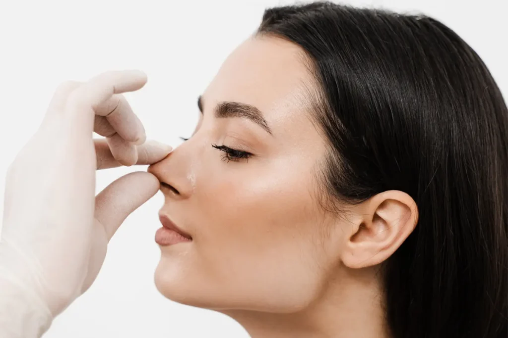 Rhinomodeling without surgery - MedSpa Grupo Estético CB Miami