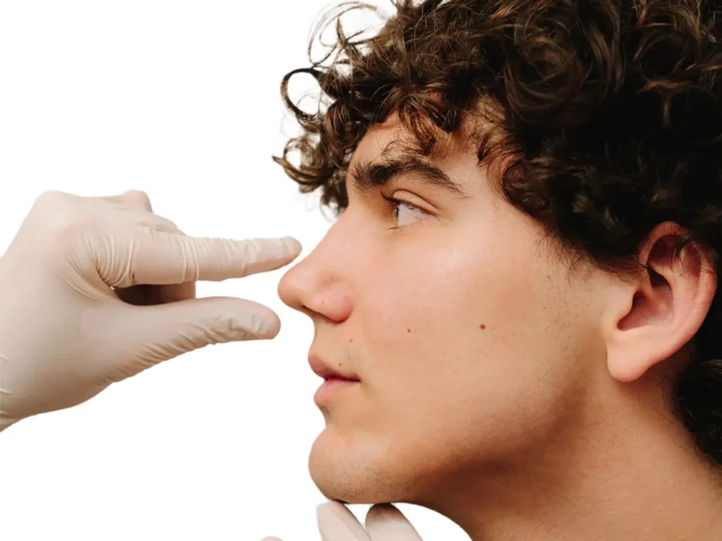 Rhinomodeling without surgery - MedSpa Grupo Estético CB Miami